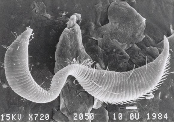 Представитель Семейства Epsilonematidae